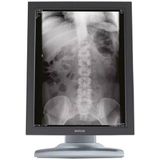 Microsoft Surface Laptop 3 - Intel Core i7-10e Generatie - 13 inch - Touch - 16GB RAM - 256GB SSD - Windows 11 Home + 1x 22 inch Monitor Zichtbaar gebruikt