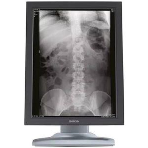 Microsoft Surface Laptop 3 - Intel Core i7-10e Generatie - 13 inch - Touch - 16GB RAM - 256GB SSD - Windows 11 Home + 1x 22 inch Monitor Zichtbaar gebruikt