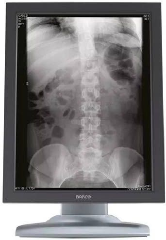 Microsoft Surface Laptop 3 - Intel Core i7-10e Generatie - 13 inch - Touch - 16GB RAM - 256GB SSD - Windows 11 Home + 1x 22 inch Monitor Zichtbaar gebruikt