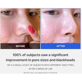 Medicube - Zero Pore Pad - 70 Stuks - Korean Skincare