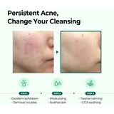 Some by Mi - AHA BHA PHA 30 Days Miracle Cleansing Bar - 95 g