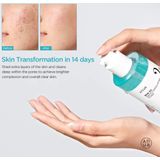 Anua - BHA 2% Milde Exfoliërende Toner - 150 ml - Salicylzuur - Ceramiden