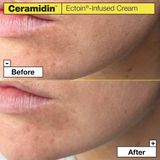 Dr. Jart+ - Ceramidin™ Ectoin-Infused Cream - Gezichtscrème - 50 ml