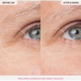 Laneige - Bouncy And Firm - Oogmasker - 20g