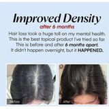 Seapuri - Scalpy - Versterkend Serum - 20 ml - Tegen Haaruitval en Dunner Wordend Haar