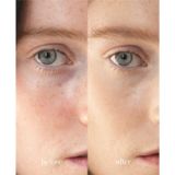 Ere Perez - Lychee Crème Corrector Uno - Concealer - 10 ml