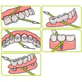 iDontix X-floss regular - 30st