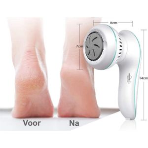 Elektrische Eelt Verwijderaar - Voetvijl - 2500rpm - USB Oplaadbaar - 3 Vijlschijven