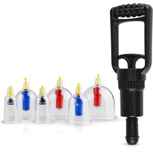 Easytoys cupping set - 6-delig zuigkrachtplezier!