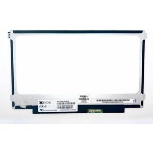 CoreParts 11.6" LCD HD Glanzend, Onderdelen voor notebooks, Zwart